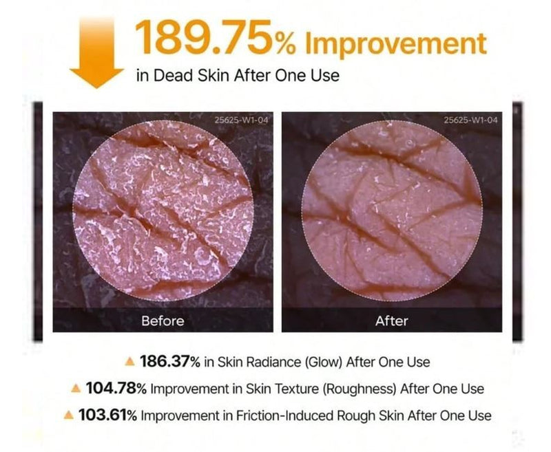 Dr. Melaxin Peel Shot Exfoliant Kojic Acid Turmeric Spray 200Ml Free Shipping
