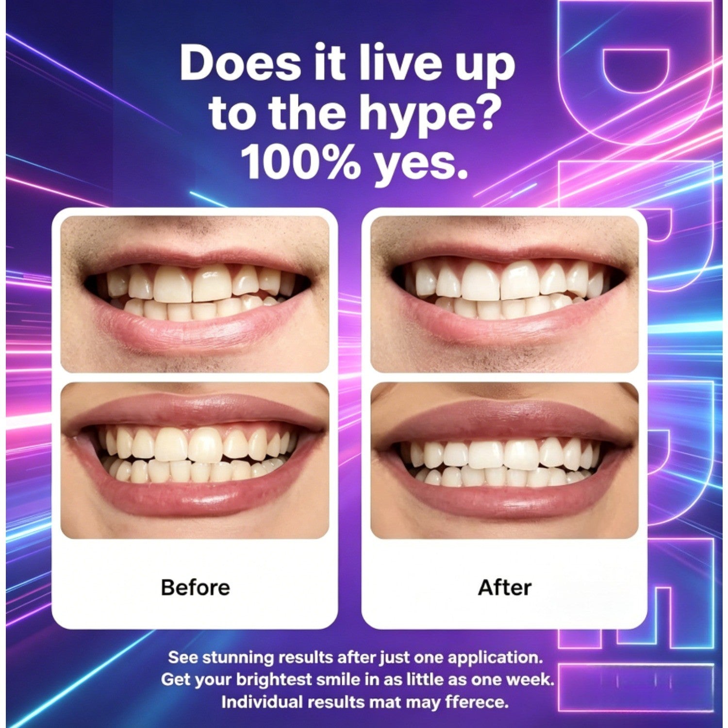 DR.DENT Purple Teeth Whitening Strips,Peroxid